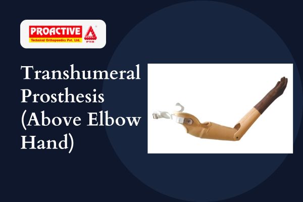 Transhumeral Prosthesis (Above Elbow) Manufacturer in India