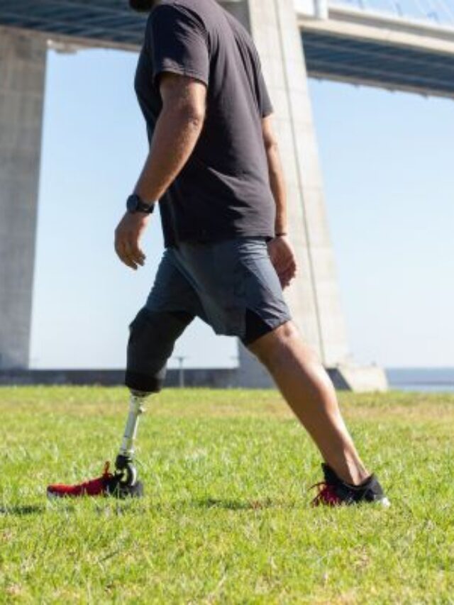 How-to-walk-with-prosthetic-leg