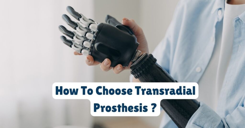 How To Choose Transradial Prosthesis