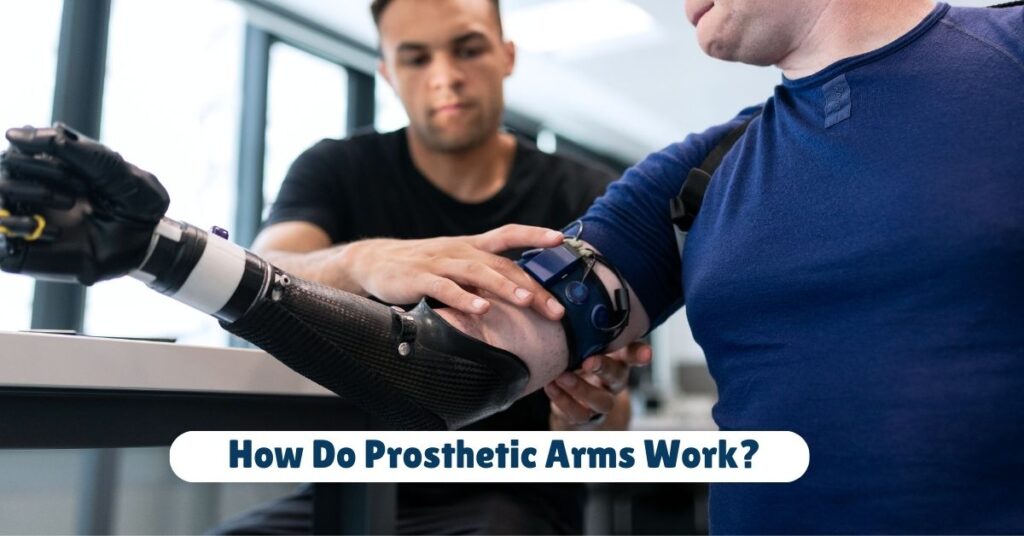 How Do Prosthetic Arms Work