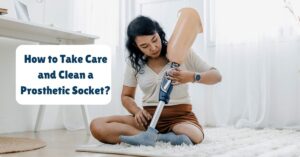 How to Take Care and Clean a Prosthetic Socket