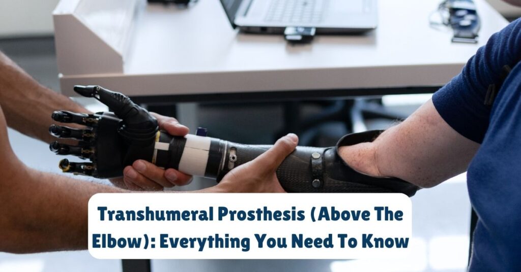 Transhumeral Prosthesis (Above The Elbow) Everything You Need To Know