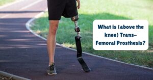 What is (above the knee) Trans-Femoral Prosthesis