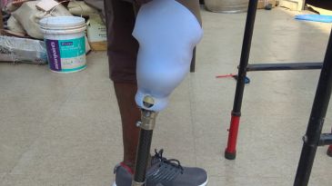 Prosthetics manufacturer