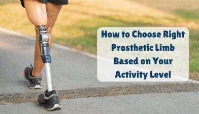 How to choose right prosthetic limb based on your activity level