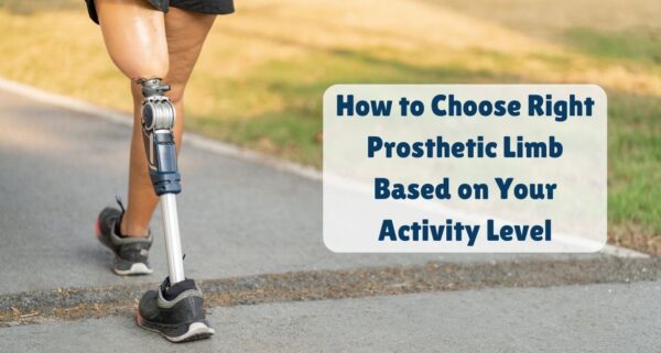 How to Choose Right Prosthetic Limb Based on Your Activity Level