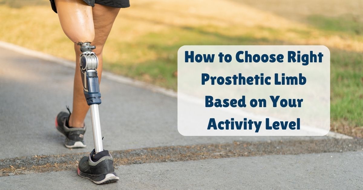 How to choose right prosthetic limb based on your activity level