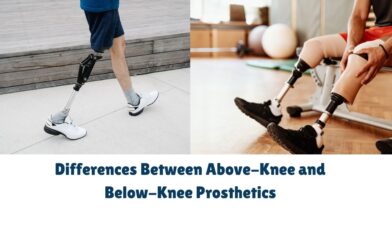 Differences Between Above-Knee and Below-Knee Prosthetics