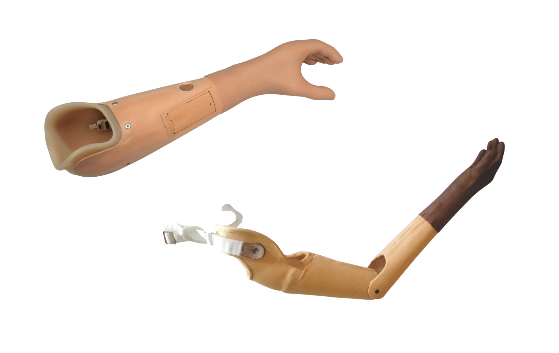 Transradial Prosthesis